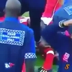 Brutal Soccer Injury