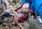 Thai Worker Turned Minced Meat Shredded By Drill