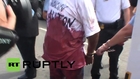USA: 'Blood-stained' anti-Castro protester arrested outside new Cuban Embassy