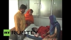 India: Three men set woman on FIRE after she resists sexual harassment *GRAPHIC*