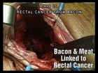 Study:Bacon May give Men Ass Cancer. No Safe Amount.Non-Vegan Meat and Fit Paleo Diet Eaters at Risk