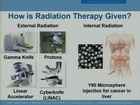 Radiotherapy for Rectal Cancer, How Does it Work: Dr  Jeff Olsen