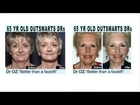 best anti aging face cream - naturacel