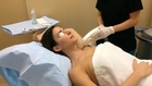 Laser Hair Removal at Jandali Plastic Surgery in Connecticut
