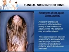 Dr. Brian Swan. COMMON SKIN INFECTIONS. VIDEO